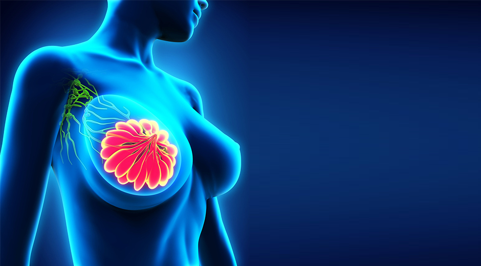 Best Treatment For Breast Cancer Screening